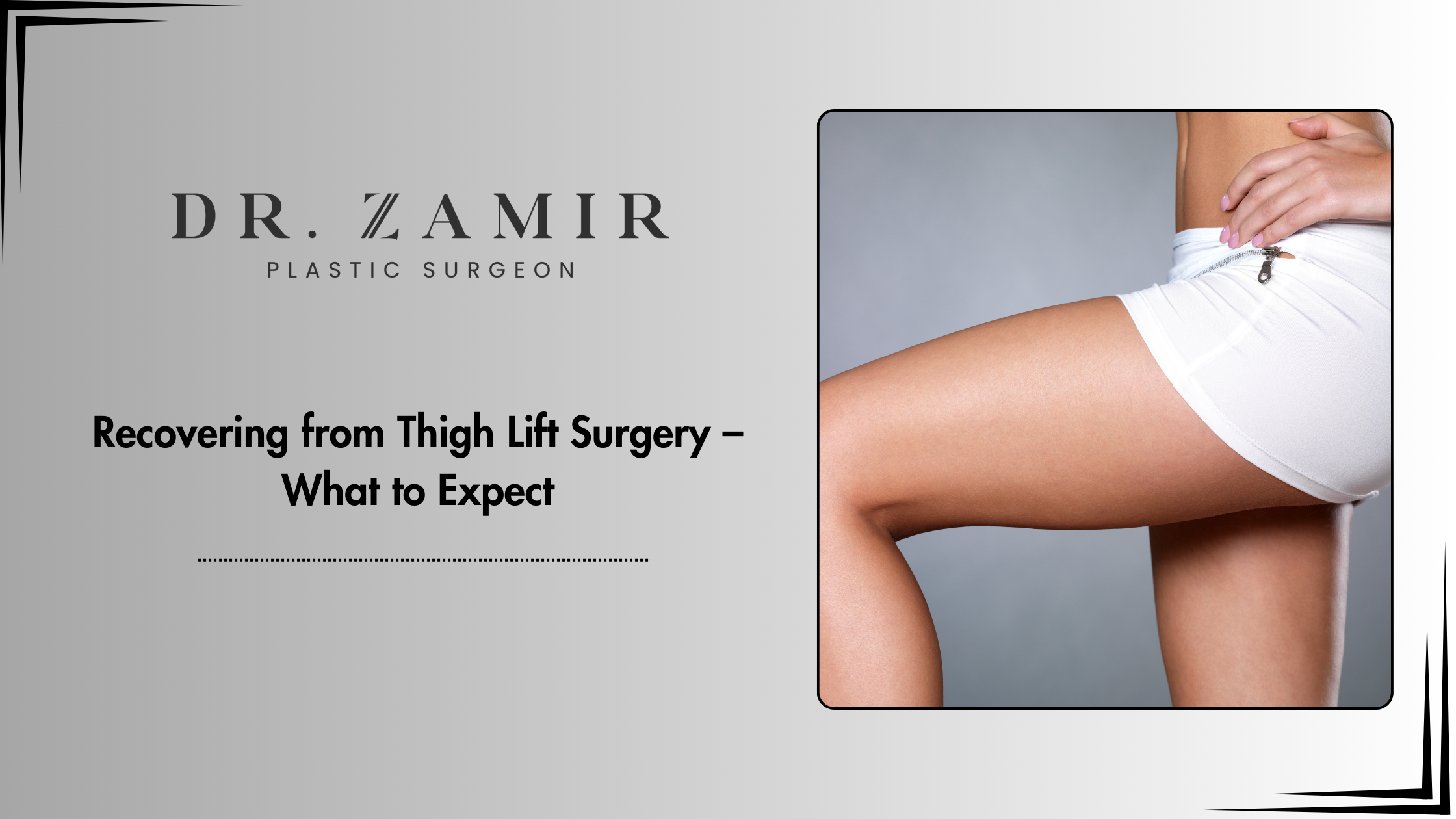 Recovering from Thigh Lift Surgery