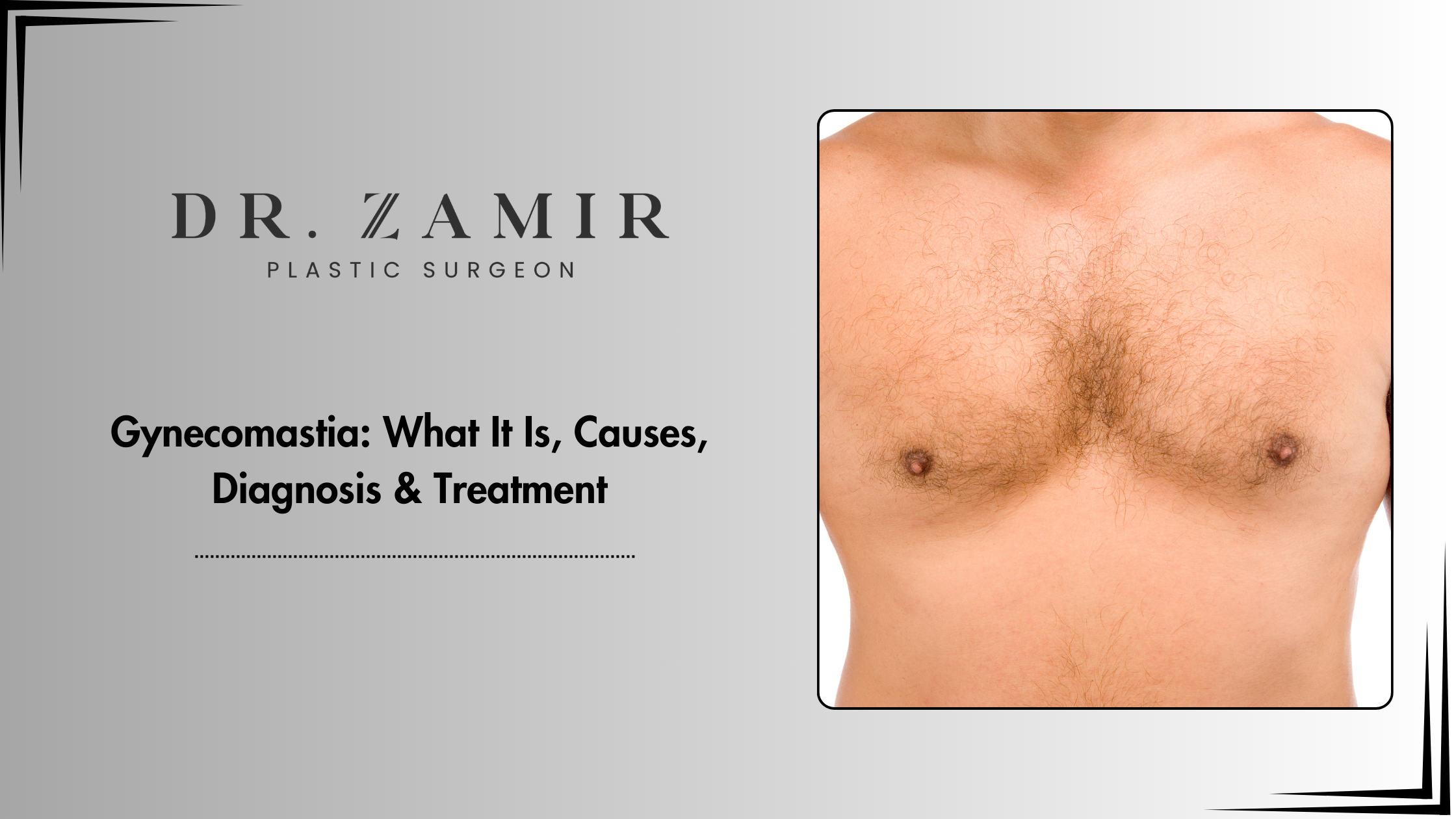 Gynecomastia treatment
