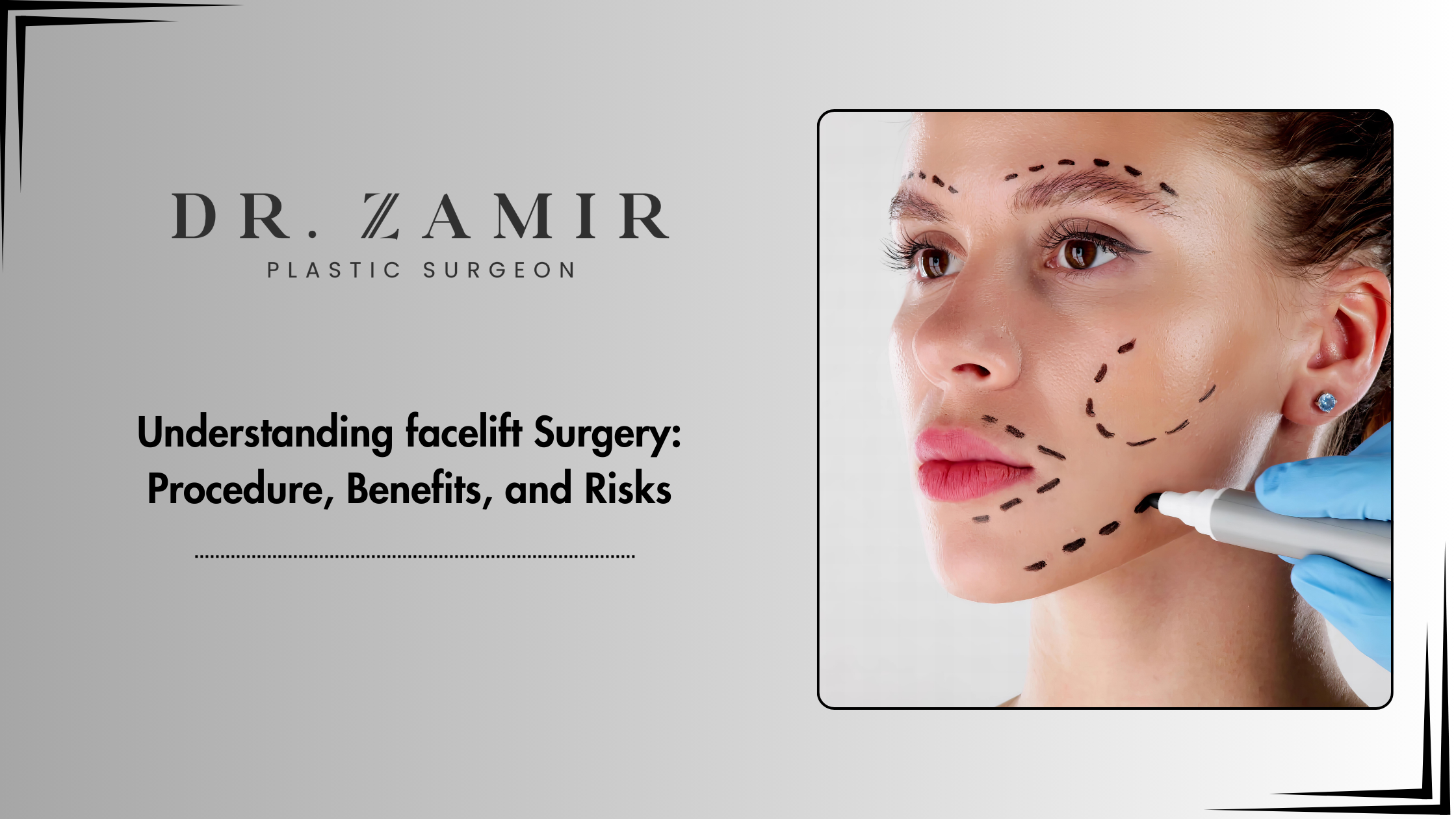 facelift surgery