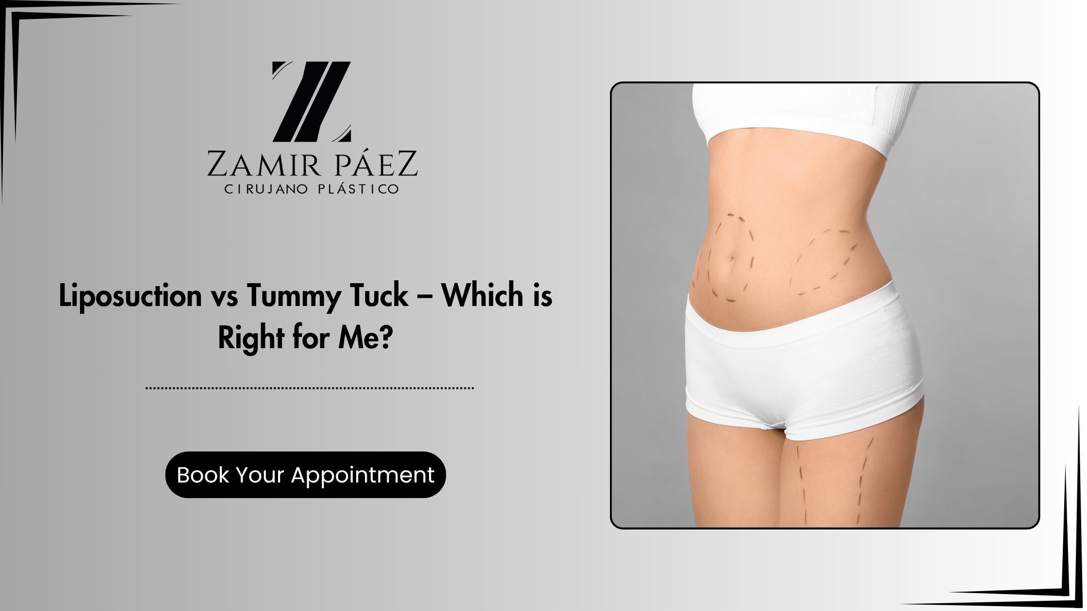 Liposuction vs tummy tuck