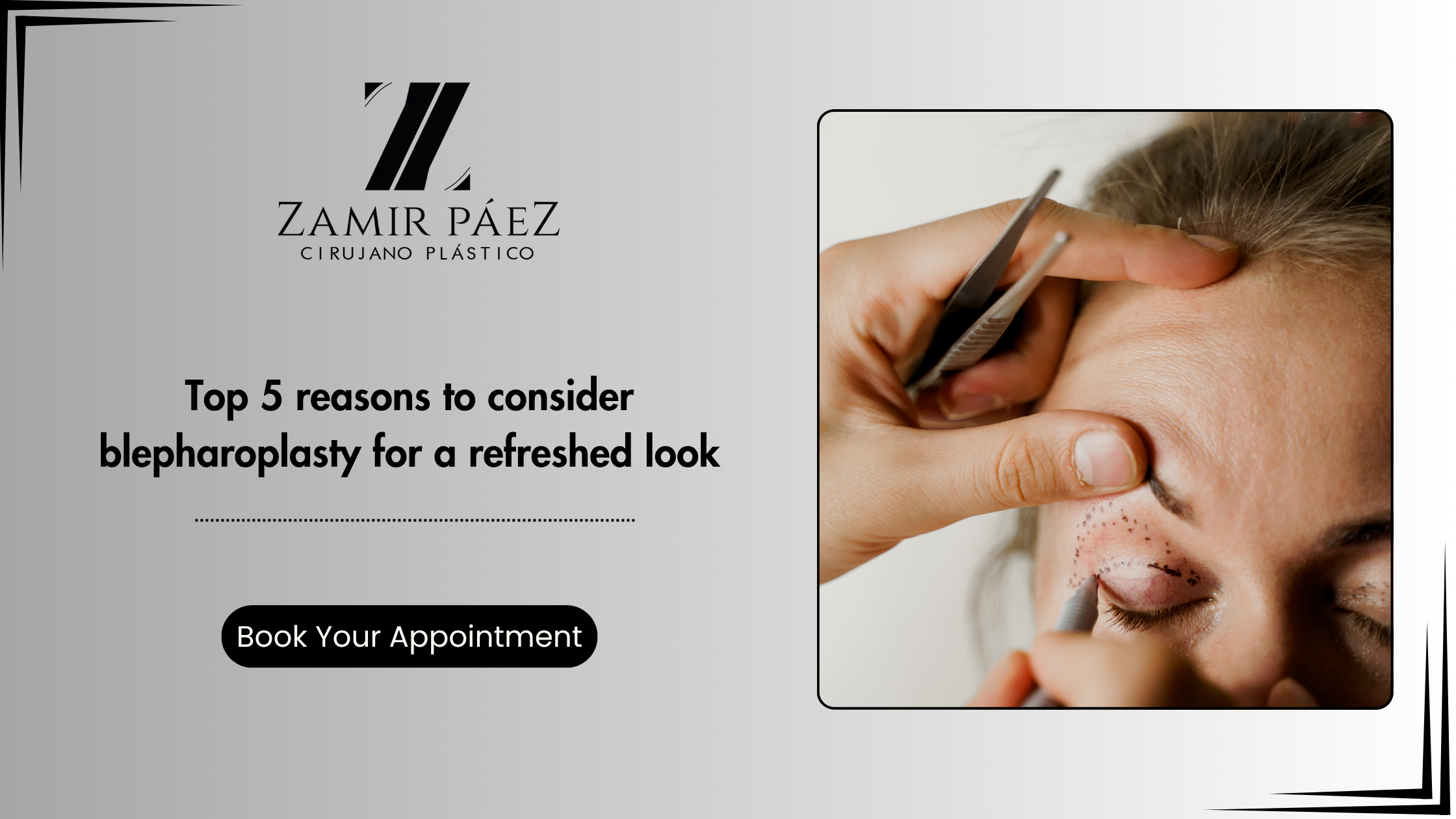 Blepharoplasty for a Refreshed Look