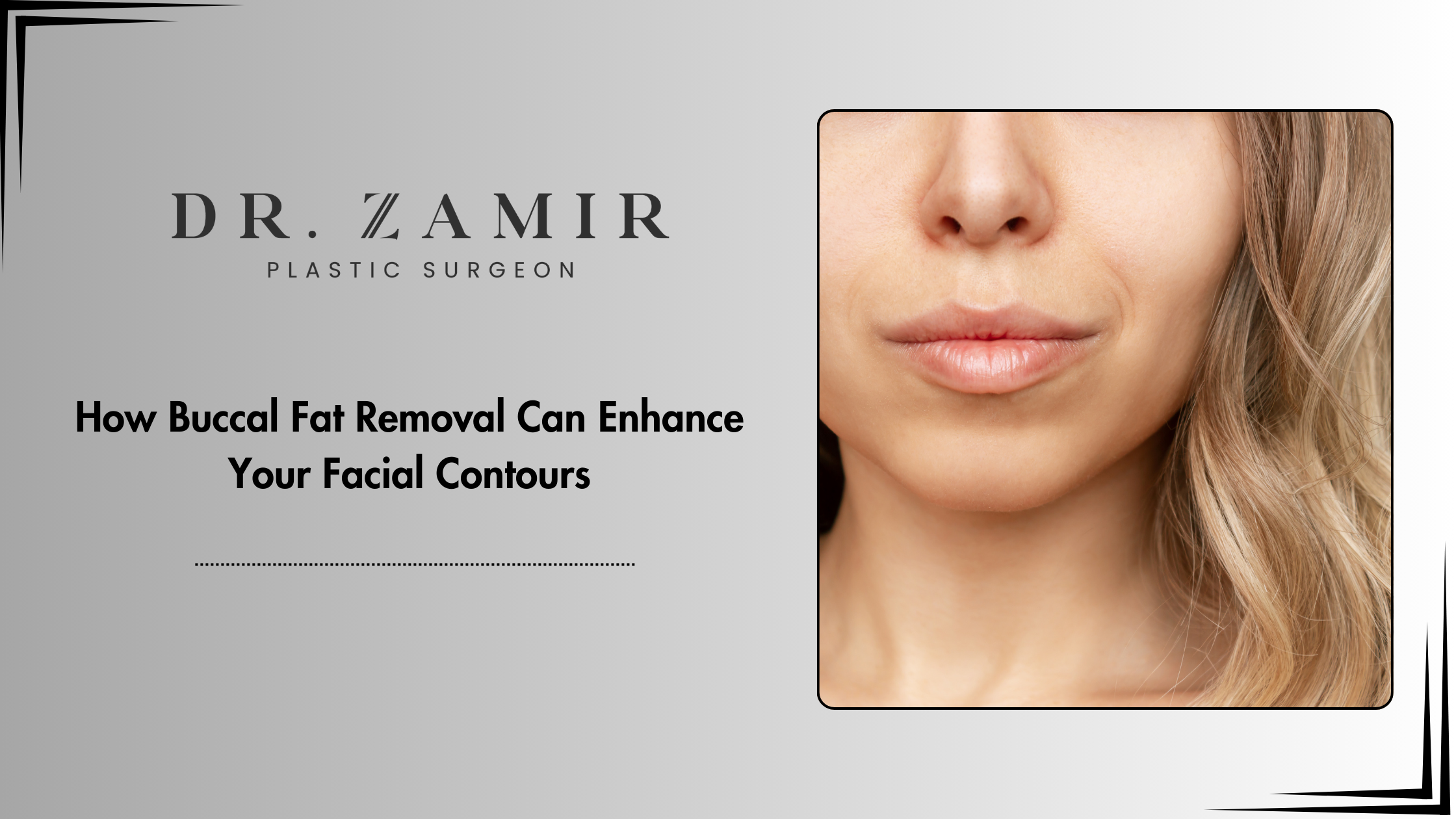 buccal fat removal