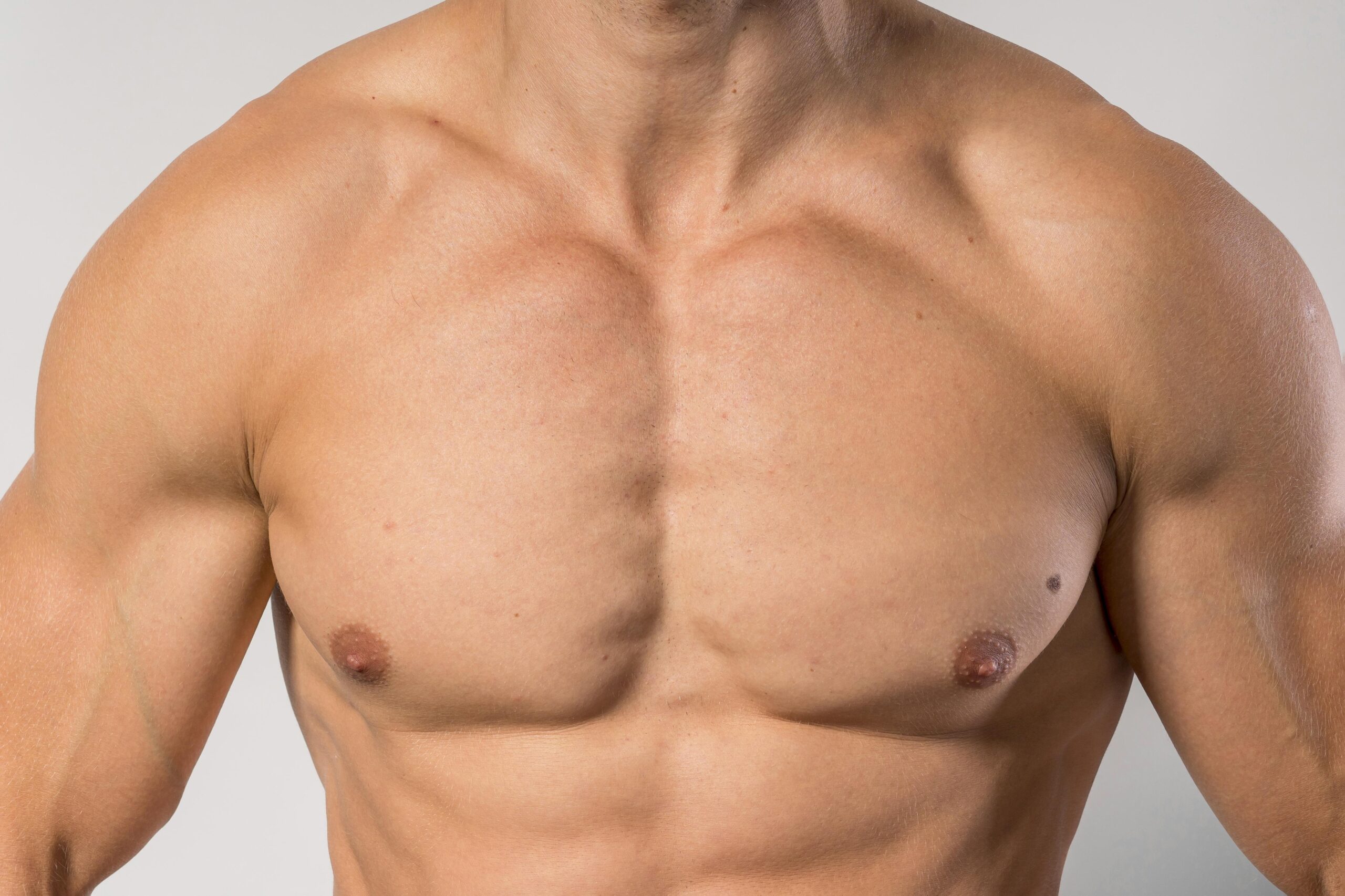 treatment of gynecomastia in male