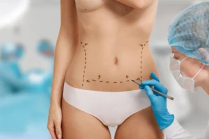 what is HD Liposculpture body contouring